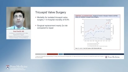 Investigational Options for Tricuspid Regurgitation 