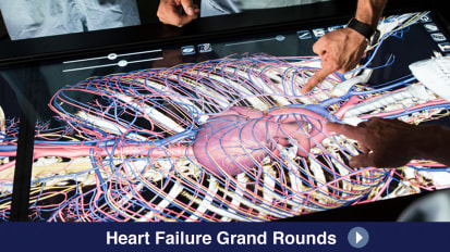 Hemodynamic assessment of heart failure