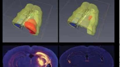 Damping Injury after Stroke: Innate Immune System Navigation can be Hacked for Stroke Protection