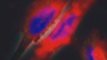 A Knockout Punch for Pediatric Brain Tumors? Targeting DIPG with Nanotechnology