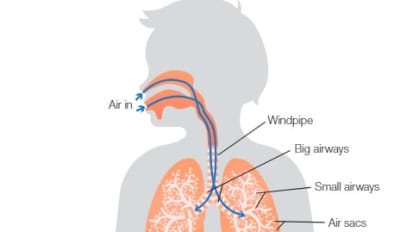 Pediatric Asthma Program