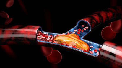 Inpatient Thromboprophylaxis in Pregnancy and Postpartum