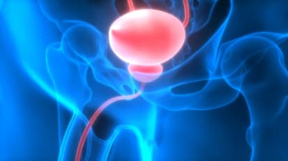 Radical Cystectomy Clinical Care Pathway