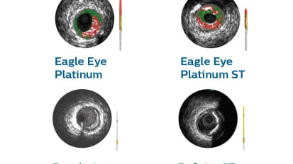 Coronary IVUS catheters Features and specifications