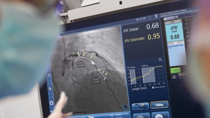 See clearly and treat optimally with SyncVision’s iFR Co-registration