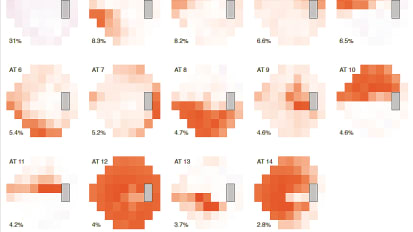 A New Study Finds Blacks Have More Advanced Visual Field Loss At First Diagnosis of Glaucoma