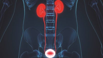 FOX CHASE-TEMPLE UROLOGIC INSTITUTE - The Next Generation of Urology Care