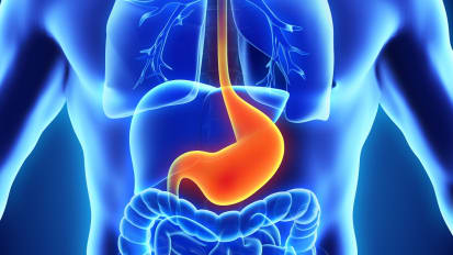 Fundoplication or Myotomy Clinical Care Pathway