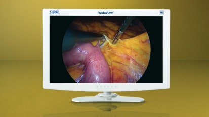 Hand Instruments tailored to your needs: Colorectal Surgery