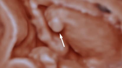 Accuracy of Multimodality Fetal Imaging