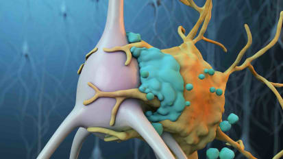 Safeguarding Neurons After Stroke