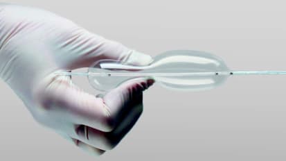 Bridge to surgery Introducing the Philips Bridge occlusion balloon for lead extraction.