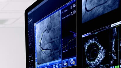 Coronary solutions: see clearly