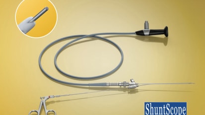 Reusable shunt scope 