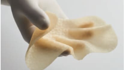 Advances in Bioabsorbable Implants for Abdominal Wall Reconstruction: Utility of GORE<sup>®</sup> ENFORM Biomaterial