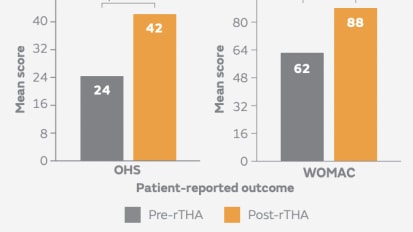 REDAPT™ Revision Femoral System Demonstrates Favourable Outcomes