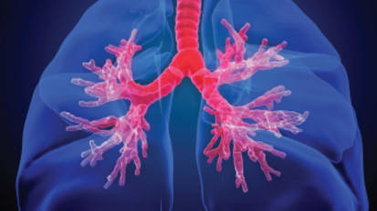 Thoracic Surgery Referral Guide