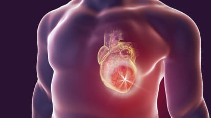 Optimizing clinical trials in acute myocardial infarction complicated by cariogenic shock: a statement from the 2020 Critical Care Clinical Trialists Workshop