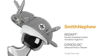 REDAPT™ Revision Acetabular Augment Design Rationale