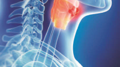 UCSF Voice and Swallowing Center