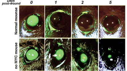 Unraveling the Wound-Healing Magic of the Corneal Epithelium