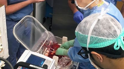 Surgeons Perform Region's 1st 'Liver in a Box' Transplant 