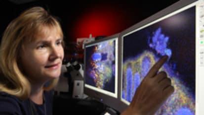 Hemorrhagic E. coli: A Therapy on the Way?