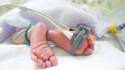 Ethics in the NICU