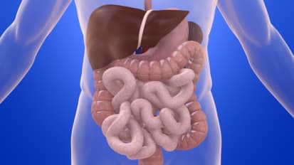 Chromoendoscopy for inflammatory bowel disease