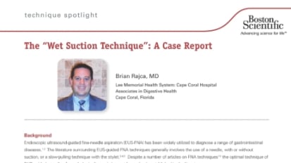 The “Wet Suction Technique”: A Case Report, Presented by Brian Rajca, MD