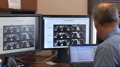 Genetically Modified T Cells for Chronic Lymphocytic Leukemia