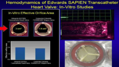 跨宿主算术敏化法
