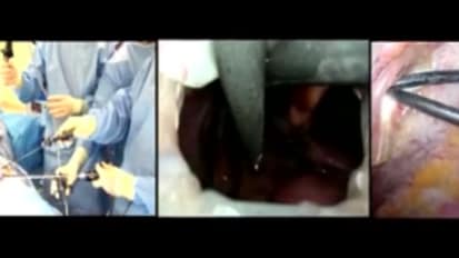 LESS Cholecystectomy Suggestions & Tips: Step 7 - When the Instrument is Inserted Incorrectly