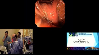 Live Case: EGD and EMR with EUS for Duodenal Cyst