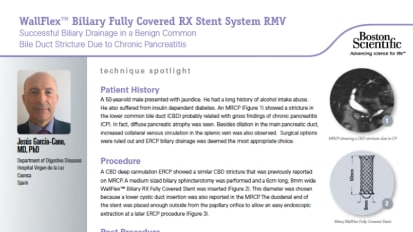 Successful Biliary Drainage in a Benign Common Bile Duct Stricture Due to Chronic Pancreatitis, presented by Jesús García-Cano, M.D., Ph.D.