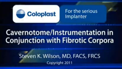 Cavernotome/Instrumentation in Conjunction with Fibrotic Corpora