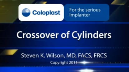 Crossover of Cylinders