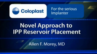 Novel Approach to IPP Reservoir Placement