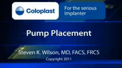 Pump Placement