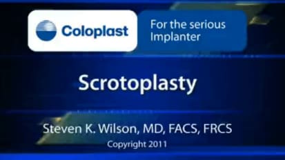 Scrotoplasty