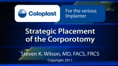 Strategic Placement of the Corporotomy