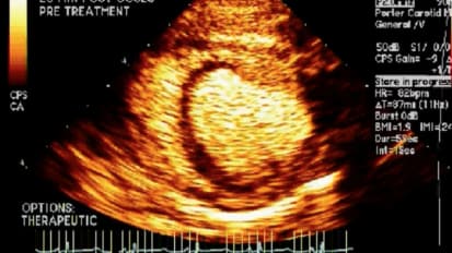 Microvascular Disease: Detection and Treatment Strategies