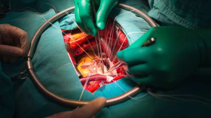 Calcific Aortic Stenosis: Key Concepts and the Road Ahead – Cardiology Grand Rounds