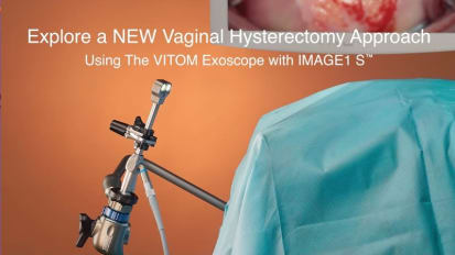 Microscopy System for Vaginal Hysterectomy