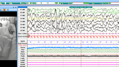 Turning Pulmonary Fellows Into Masters of Ultrasonography