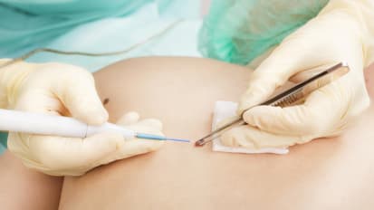 SSSRda erotika va jinsiy aloqa