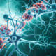 Cedars-Sinai investigators have found that immune cells in the brain–shown here in purple and orange–protect against delirium, which is common among patients placed on mechanical ventilation. Illustration by Getty.