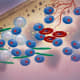 Multiple myeloma cells illustration