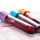 A new review article recommends fewer lab tests for hospitalized patients.