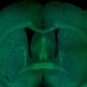 Coronal section of a mouse brain, with several major axonal tracts stained green.